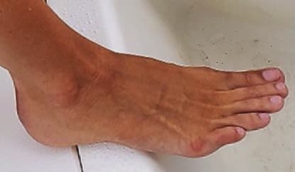 Pinky Toe Pat profile