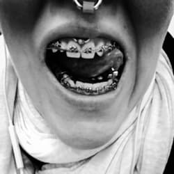 Teethshow profile